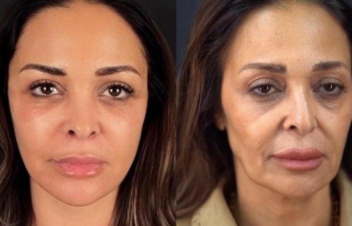 بعد تصدرها التريند.. تفاصيل عملية تجميل داليا البحيري - بوابة نيوز مصر