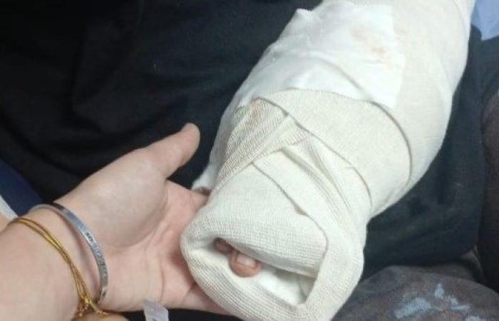 «كف إيدي اتقطع».. إصابة فتاة تكشف كواليس الإهمال داخل ماركت شهير بأكتوبر | تفاصيل - بوابة نيوز مصر