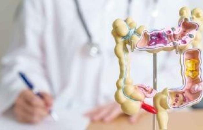 سرطان القولون والمستقيم.. أعراض يجب الانتباه لها وطرق الوقاية - بوابة نيوز مصر