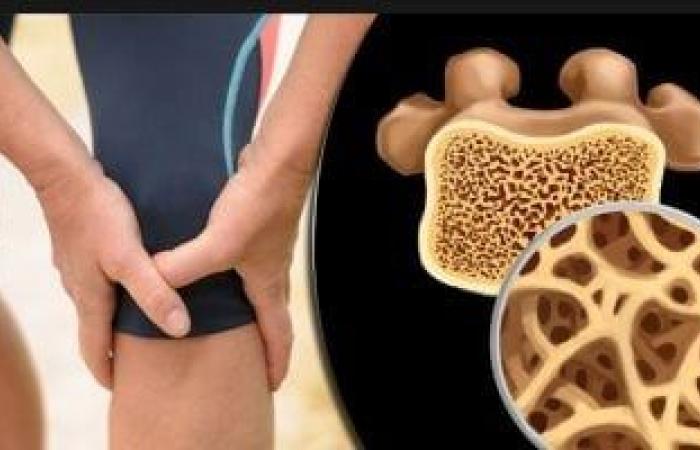ألم العظام.. الأسباب الشائعة والخطيرة وطرق التشخيص والعلاج - بوابة نيوز مصر